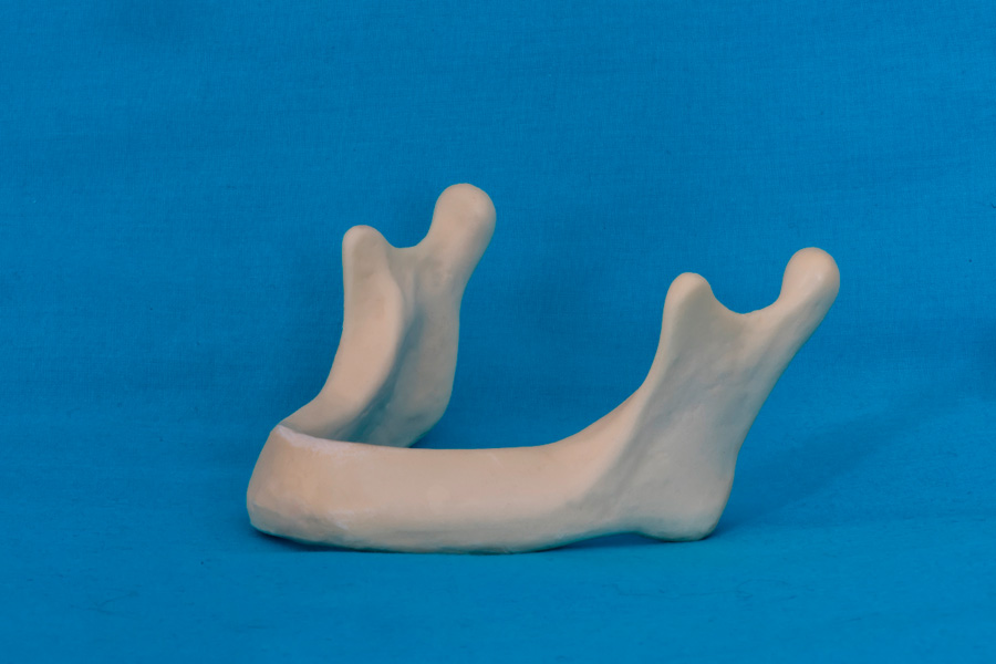 modelli dentali bimodels tailor-made dental models