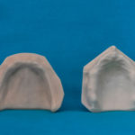 modelli dentali bimodels tailor-made dental models