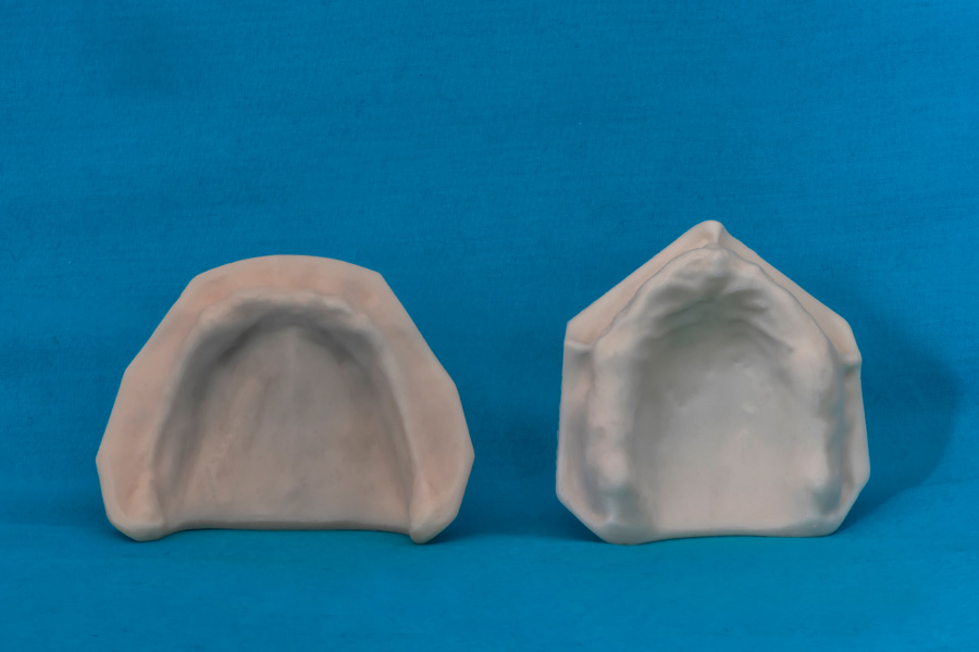 modelli dentali bimodels tailor-made dental models