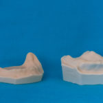 modelli dentali bimodels tailor-made dental models