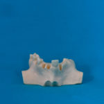 modelli dentali bimodels tailor-made dental models