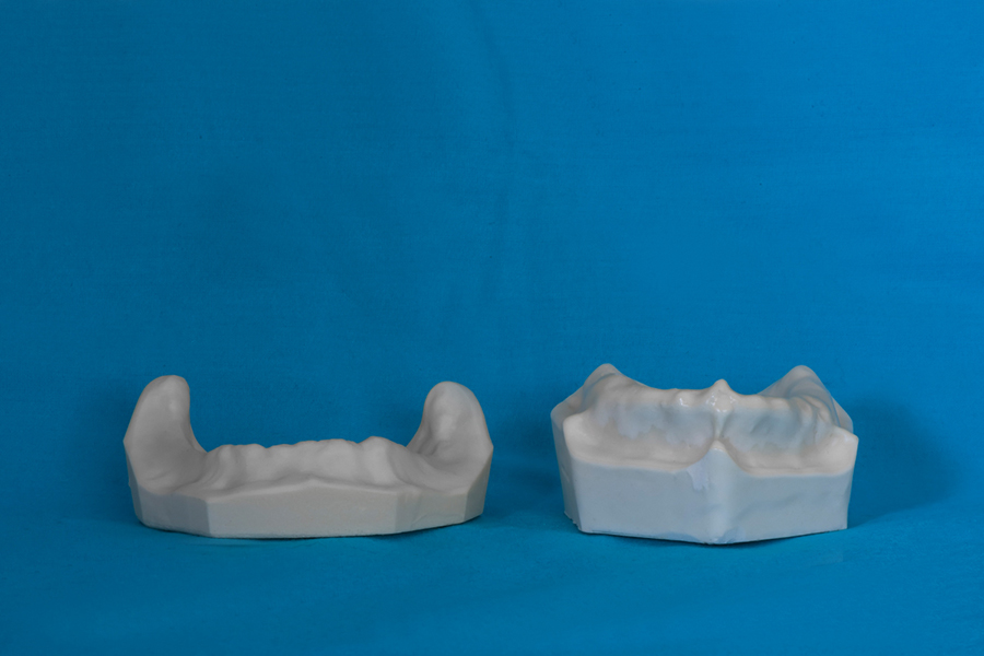 modelli dentali bimodels tailor-made