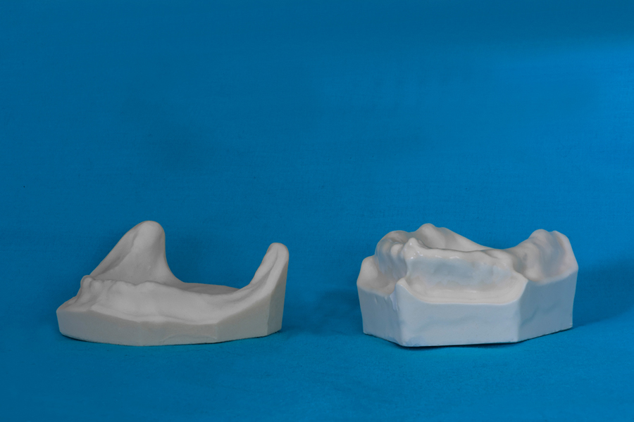 modelli dentali bimodels tailor-made